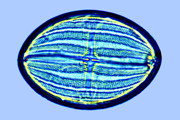 Amphora Cocconeis heteroidea